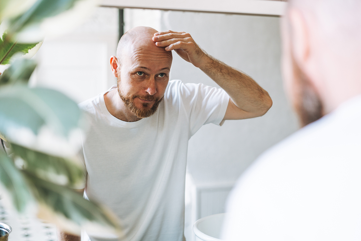 doctor, alopecia, injerto, cabello, calvicie, salud, cirugÃ­a